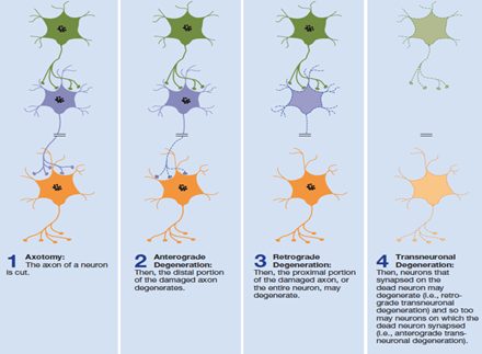 <p>important aspect of <strong>brain development</strong></p><ul><li><p>observed in a <strong>healthy nervous system</strong> in early development</p></li></ul><p>but also a characteristic of <strong>disease </strong>and <strong>neuron death</strong></p><p><strong>synaptic pruning</strong> during childhood</p><p>3 types:</p><ul><li><p><strong>anterograde</strong></p></li><li><p><strong>retrograde</strong></p><ul><li><p>these 2 from <strong>axotomy </strong>(a cut in an axon)</p></li></ul></li><li><p><strong>transneuronal</strong></p></li></ul><p></p>