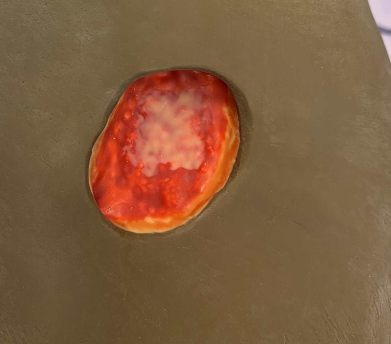 <p>what wound is this?</p>