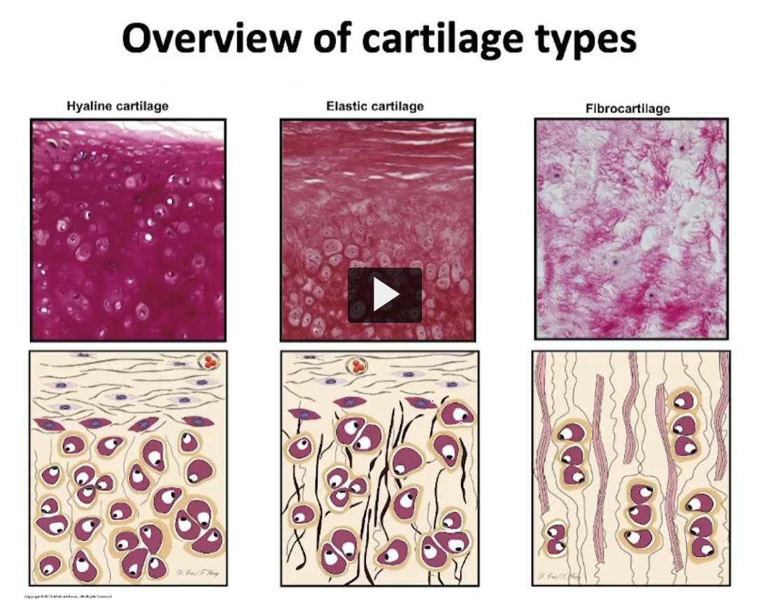 <p>For example, hyaline cartilage, elastic cartilage, and fibro cartilage </p><p>Where can I see hyaline cartilage? In the anterior portion of your nose, there is a mass of hyaline cartilage. The costal cartilage of your rib cage, where you join the rib to the sternum in the thoracic cage </p><p>The elastic cartilage contains elastic fibers in its extracellular matrix, it can be seen in the auricle of your external ear. </p><p>Finally, fibrocartilage that can be found in intervertebral discs and in the meniscus. </p><p>She is going to explain the characteristics of cartilage. We will start with hyaline and eventually we will discuss the other two, I will show you what makes each one of them distinctive. which I think is the easiest way to visualize these three types of cartilage. </p>