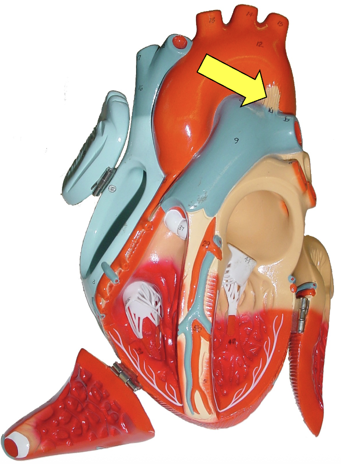 <p>what part of the heart muscle is shown?</p>