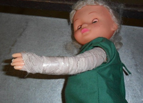 <p><span>fracture of the radius and ulna with open wound swelling and infection</span></p>