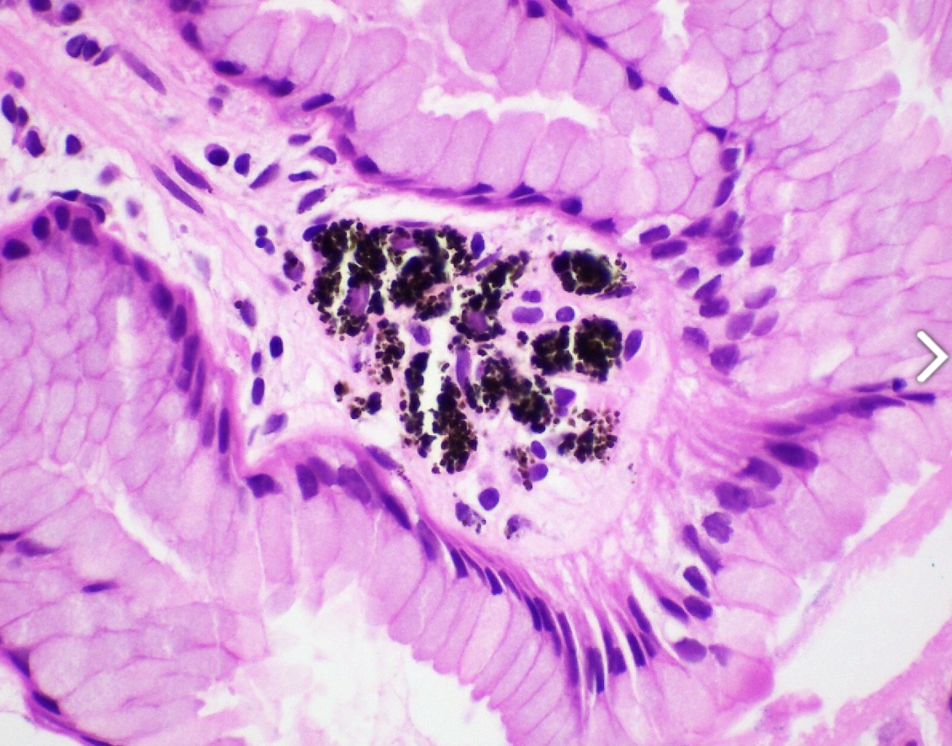 <p>1) diagnostic </p><p>2) coloration + </p>