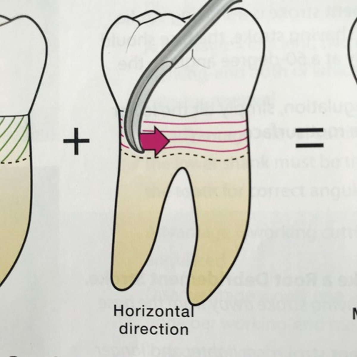 <p>- on tooth surface</p><p>- Use a combination of vertical, oblique and horizontal strokes.</p>