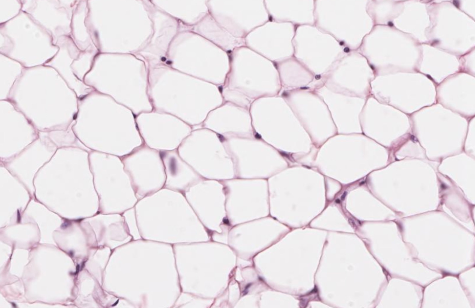 <p>composed of Adipocytes. Used for FAT STORAGE. it is the hypodermis (layer under the skin)</p>