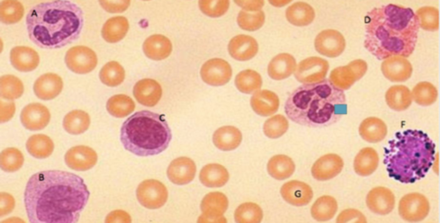 <p>Identify the following blood-formed element</p>