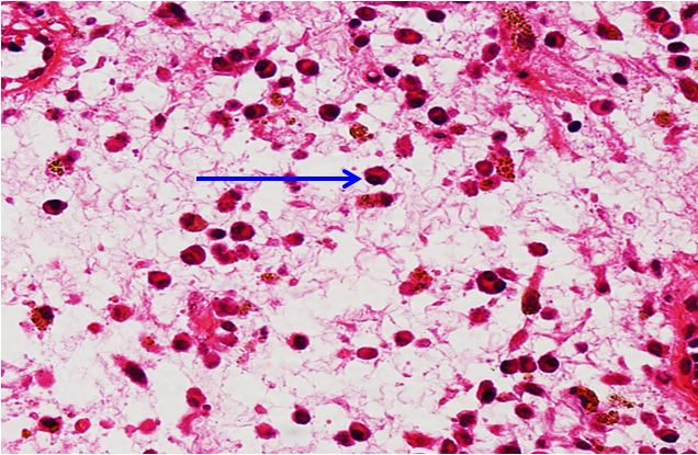 <p>Tế bào gì ?</p>