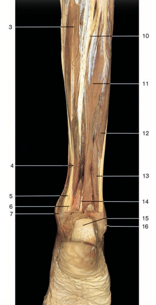 <p>Pinche 5</p>