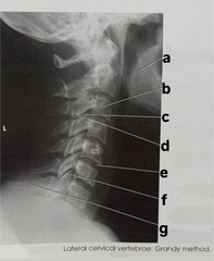 <p>label (a-d) lateral cervical vertebrae grandy method</p>