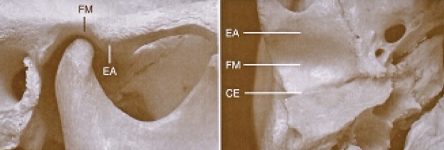 <p>Protruding dense convex bone in front of the fossa</p><p>Varying level of convexity</p><p>Guides movement of condyle, primary load bearing area</p><p>Ginglymoarthrodial joint- Ginglymoid (hinging) AND arthrodial (sliding joint)</p>