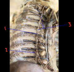 <p>What is labeled 1?</p>