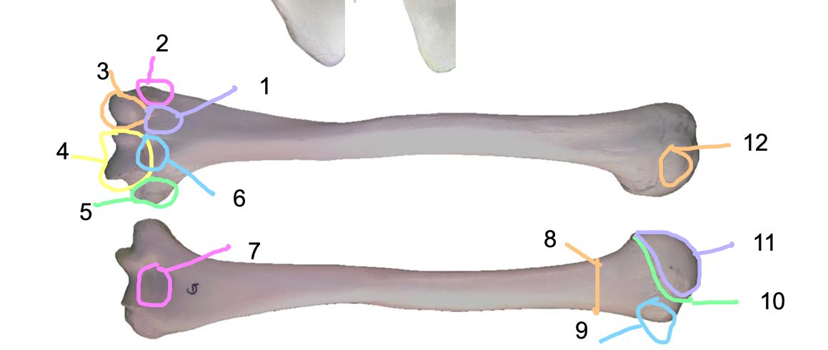 <p>Structure 4</p>