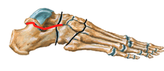 <p>Articulation of the talus and calcaneous</p>