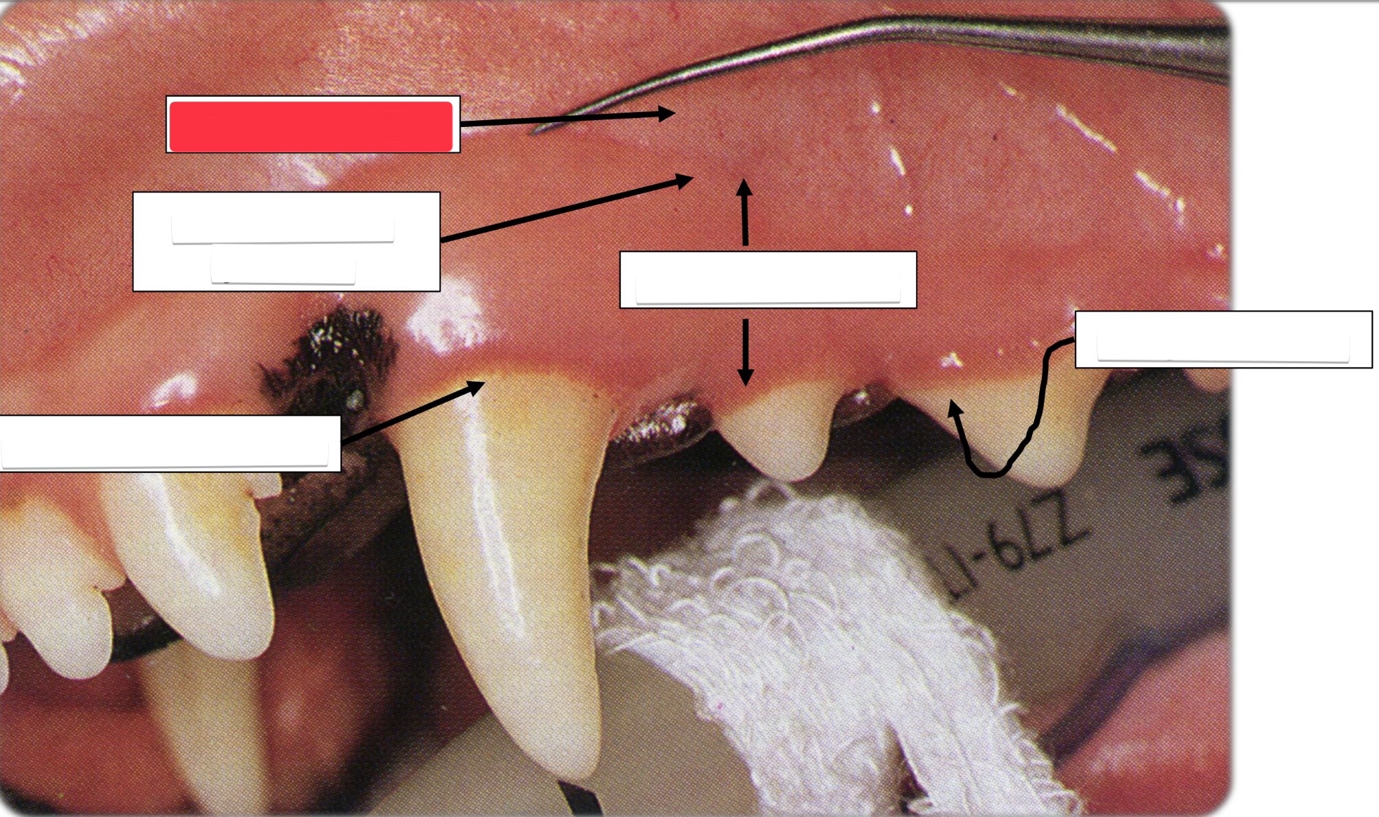 <p>Label this part of the gingiva.</p>