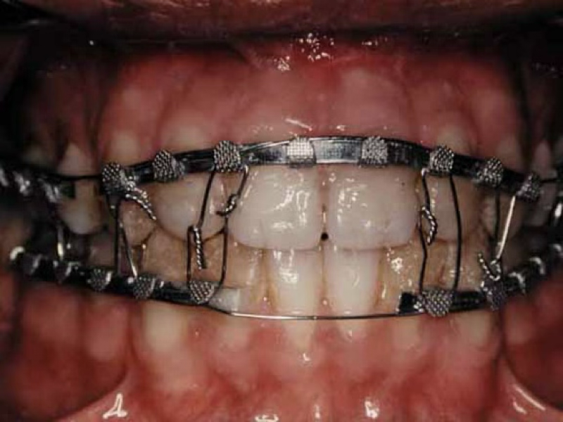 <p>10 cm</p>