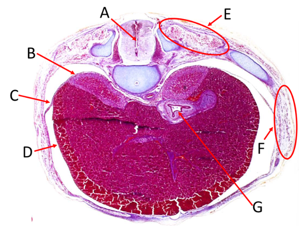 <p>Label A, B, C, D, E, F and G</p>
