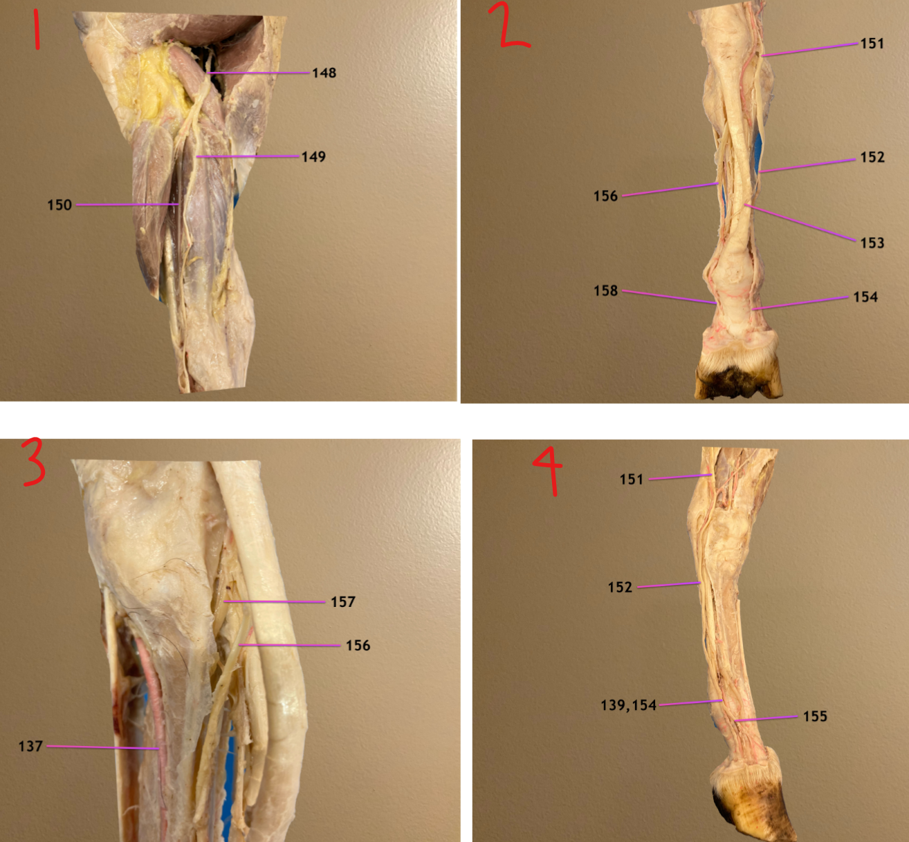 <p>pic 1: cranial view of crus, transected muscle at top is vastus lateralis </p><p>pic 2: plantar view of tarsus to hoof showing branches of 151</p><p>pic 3: zoomed in lateral view</p><p>pic 4: medial view of tarsus to hoof, cranial to rt </p><p>.</p><p>label 152-155</p>