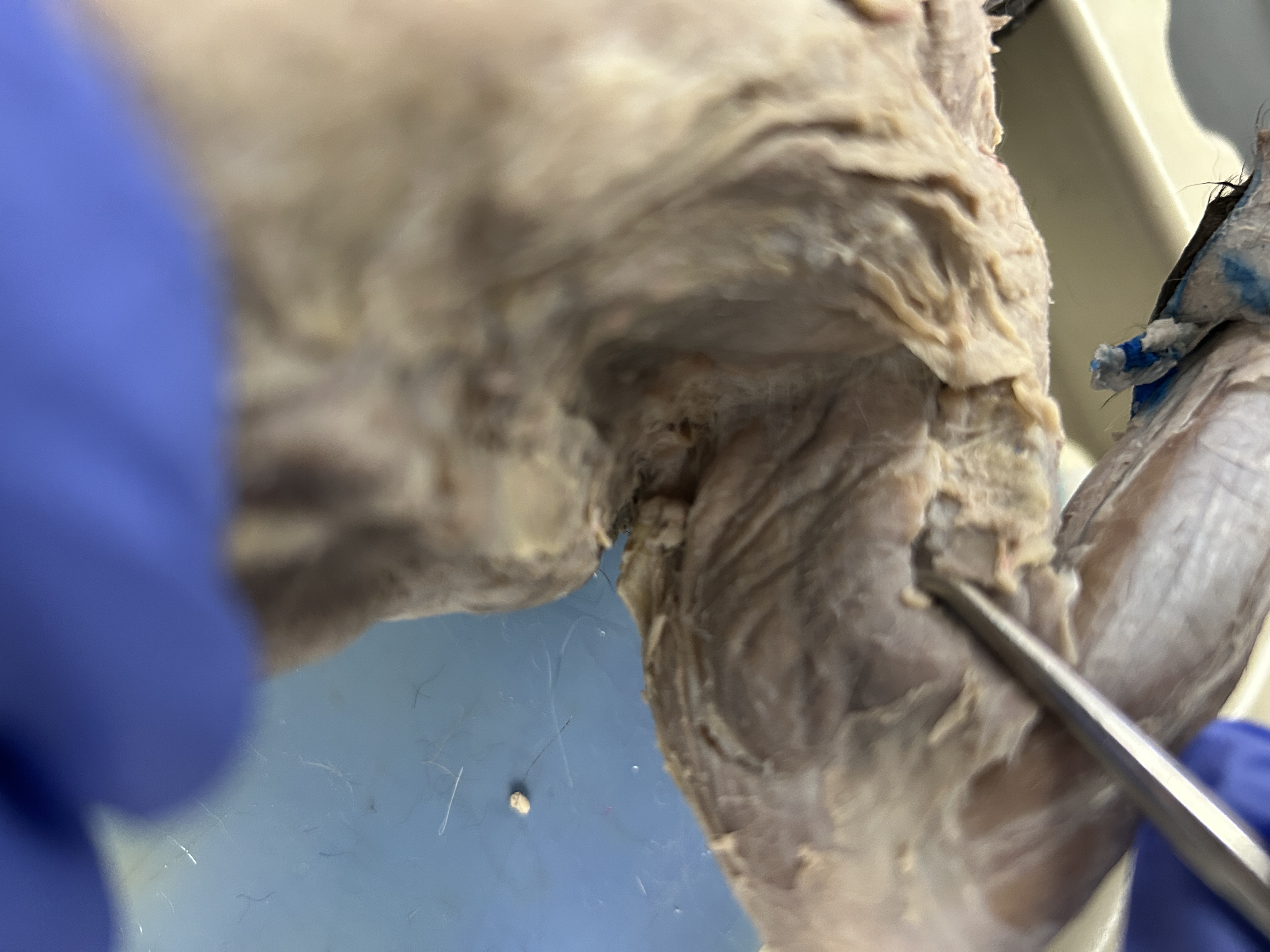 <p>Epitrochlearis (circle flap under arm near armpit ) </p>