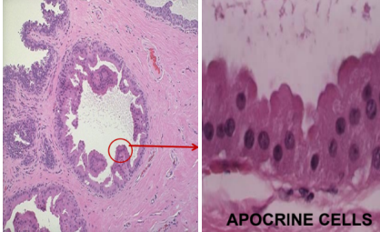 <p>What pathology? </p>