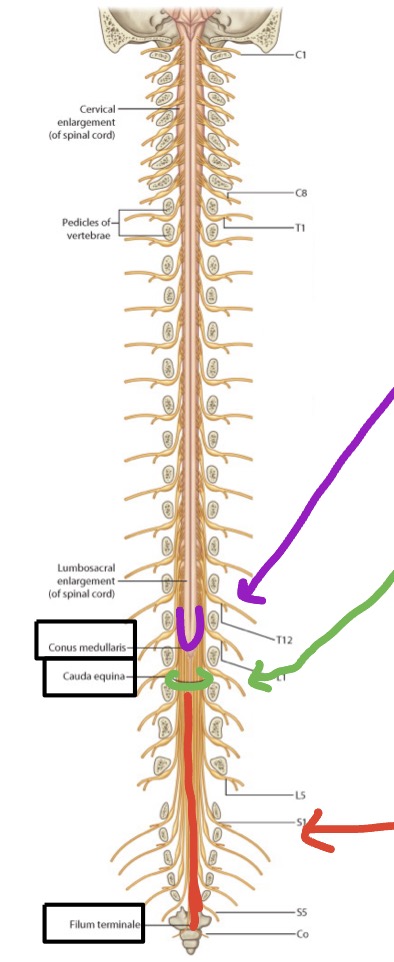 <ul><li><p><span style="color: rgb(118, 16, 211);"><strong>Conus medullaris</strong></span><span><strong> </strong>= </span>Distal tapered end of spinal cord </p></li><li><p><span style="color: rgb(9, 169, 5);"><strong>Cauda e</strong></span><span style="color: rgb(9, 169, 5);"><strong>quina</strong></span><span style="color: rgb(18, 170, 10);"><strong> = </strong></span><span style="color: rgb(5, 5, 5);">Collection of spinal nerve roots that extend inferior to spinal cord → also called “Horse’s tail” </span></p></li><li><p><span style="color: rgb(246, 15, 15);"><strong>Filum terminale</strong></span><span style="color: rgb(5, 5, 5);"> = Extension of pia mater from the conus medullaris, anchoring to the posterior surface of the coccyx </span></p></li></ul><p></p>