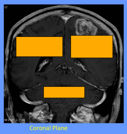 <p>Label this image </p>