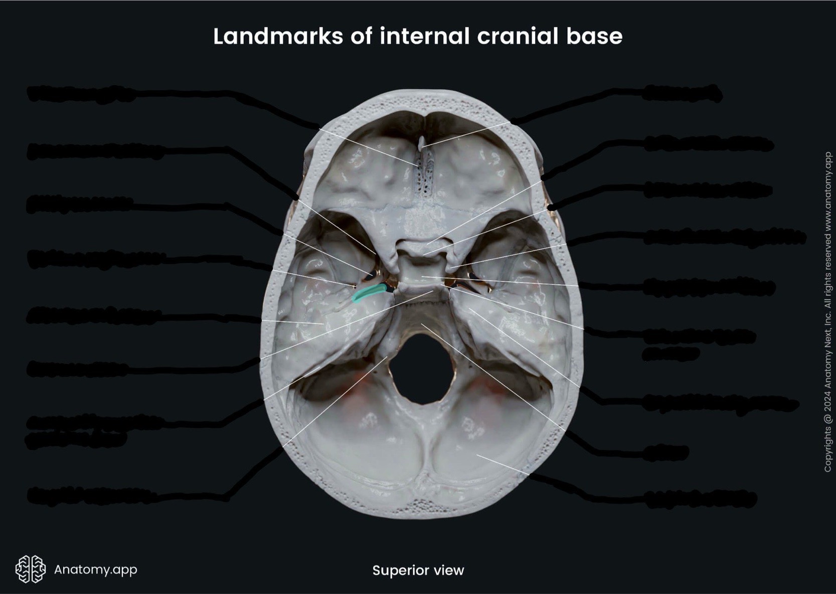 <p>What is the highlighted bony landmark</p>