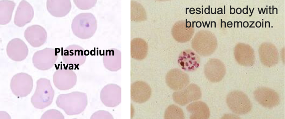 <ul><li><p>protozoa </p></li><li><p>causes malaria </p></li></ul><p></p>