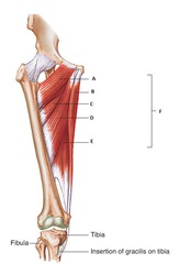 <p>Definition: A short, triangular muscle located in the upper inner (medial) thigh. It primarily adducts the thigh (moves it toward the body's midline). It lies deep to the pectineus and adductor longus. (C)</p><p> - Action: Adduct hip (thigh) </p><p> - Innervation: Obturator nerve</p>