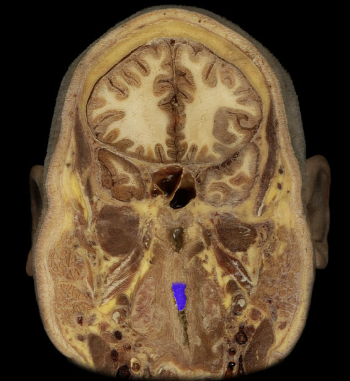 term image