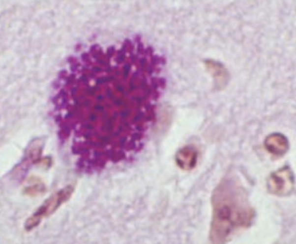 <p>What is this? (in brain of infected mouse)</p>