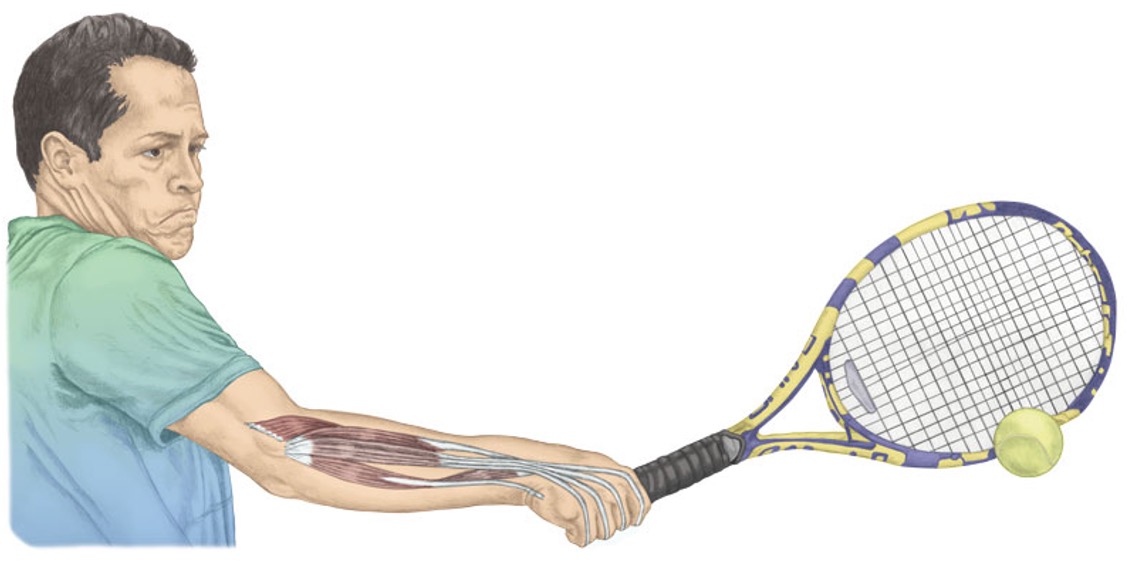 <p><span>extensor carpi radialis longus and brevis</span></p><p style="text-align: left;"><span>extensor carpi ulnaris</span></p><p style="text-align: left;"><span>extensor digitorum</span></p><p style="text-align: left;"><span>extensor indicis&nbsp;</span></p>