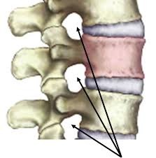<p>- vertebrae have articular facets and vertebral canal</p><p>- vertebral bodies are separated by intervertebral discs</p><p>- resulting in a space called the intervertebral foramina</p>