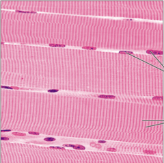 <p>name the tissue: long, cylindrical, multinucleate cells; obvious striations</p>