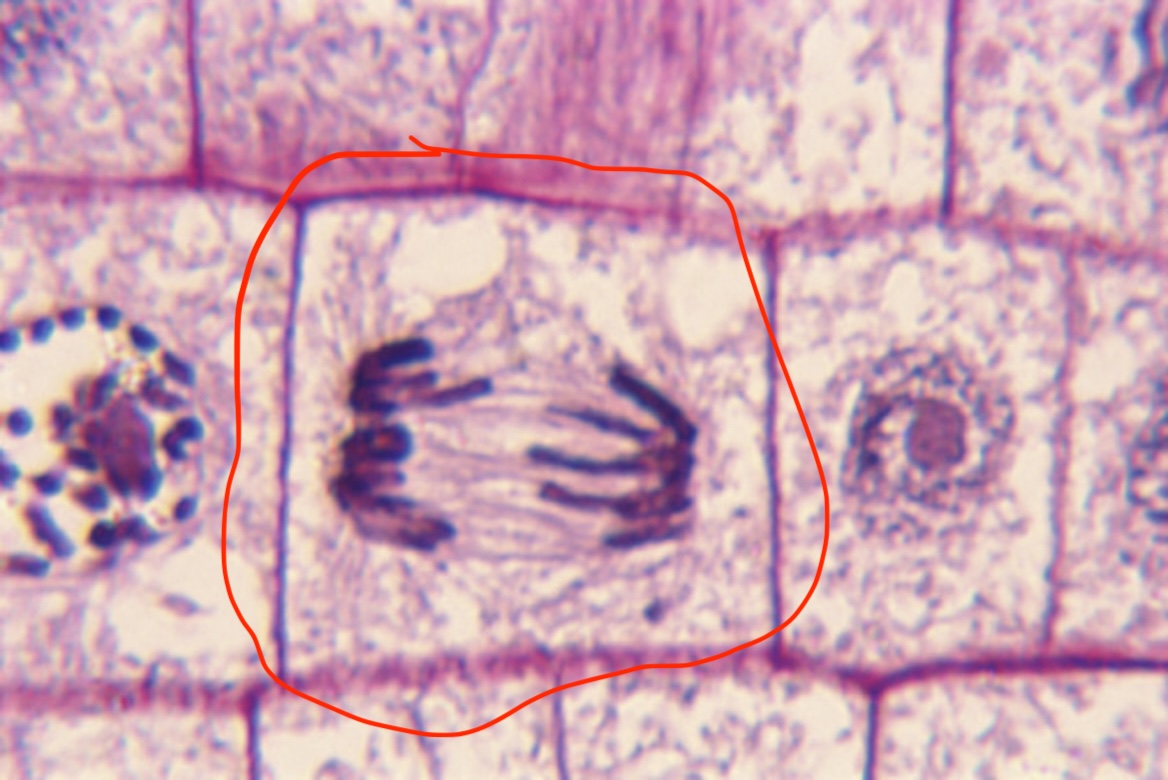 <p>What stage of mitosis is this?</p>