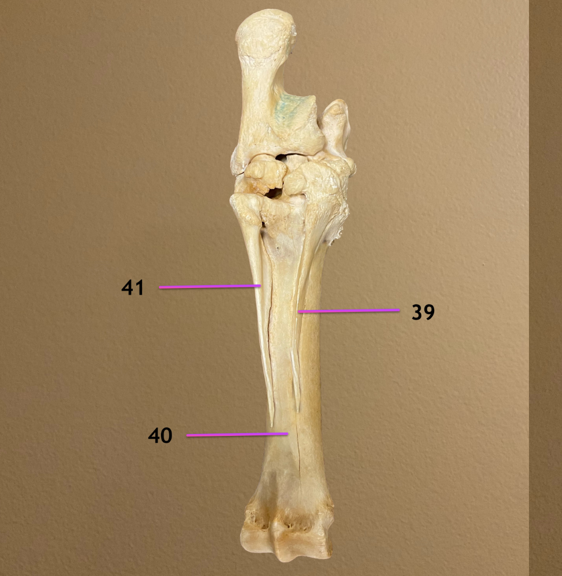 <p>plantar view</p><p>.</p><p>label 39-41</p><p>INCLUDE ANATOMICAL &amp; COMMON NAME FOR ALL</p>