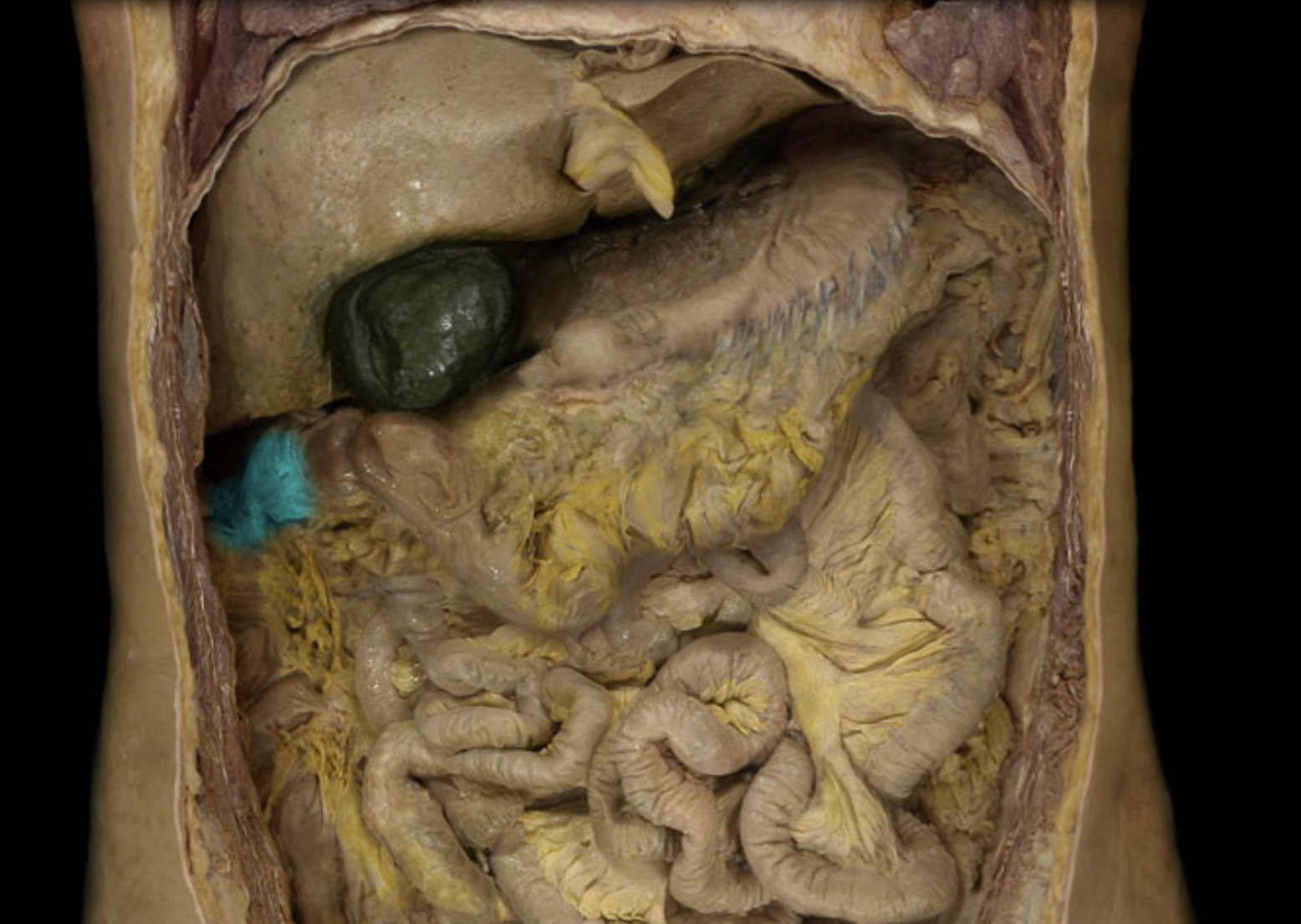 term image