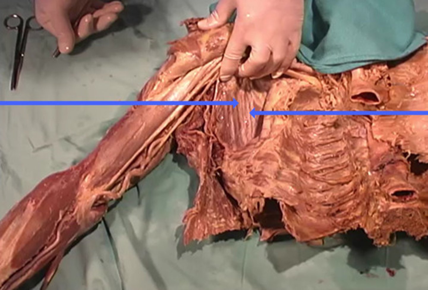 <p>Where do these muscles fibers insert?</p>