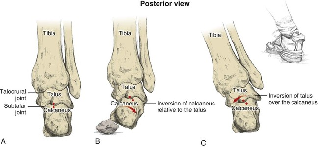 <p>Inversion </p><p>(Subtaar Joint)</p><p>WHAT MUSCLES?</p>