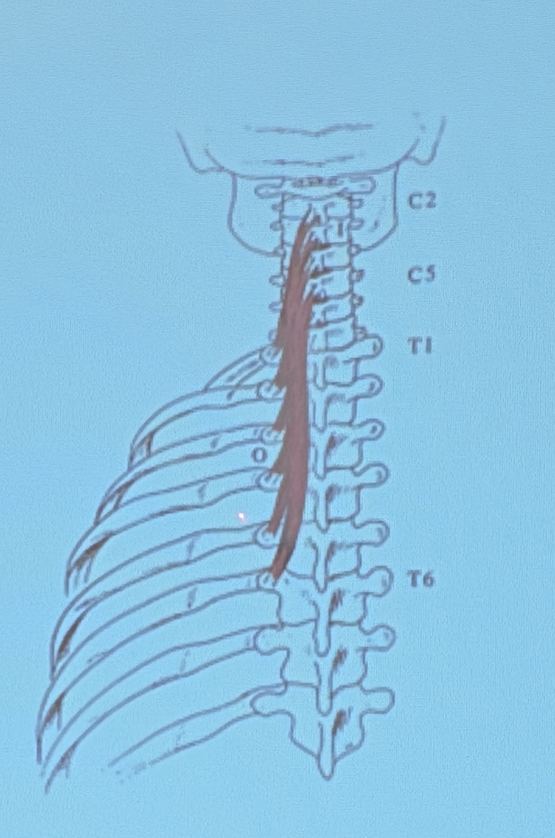 <p>Muscle name?</p>