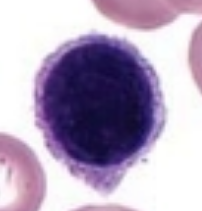 <p>what is it (Staining Blood Smears)</p>