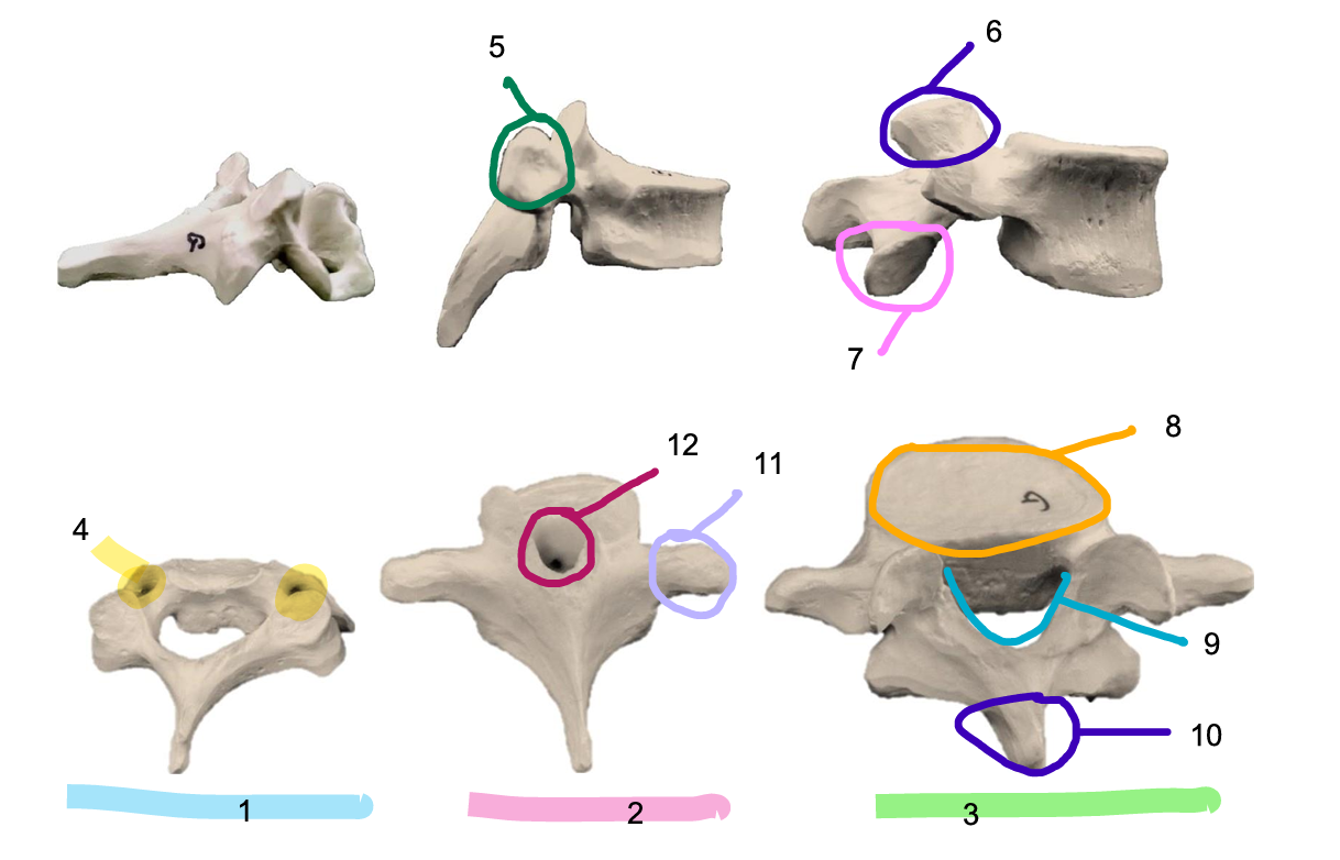 <p>Structure 1</p>