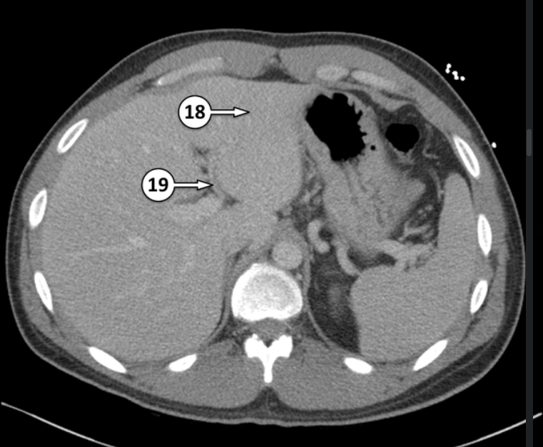 <p>Please label 18 and 19</p>
