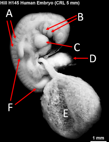 <p>Label A, B, C, D, E and F</p>