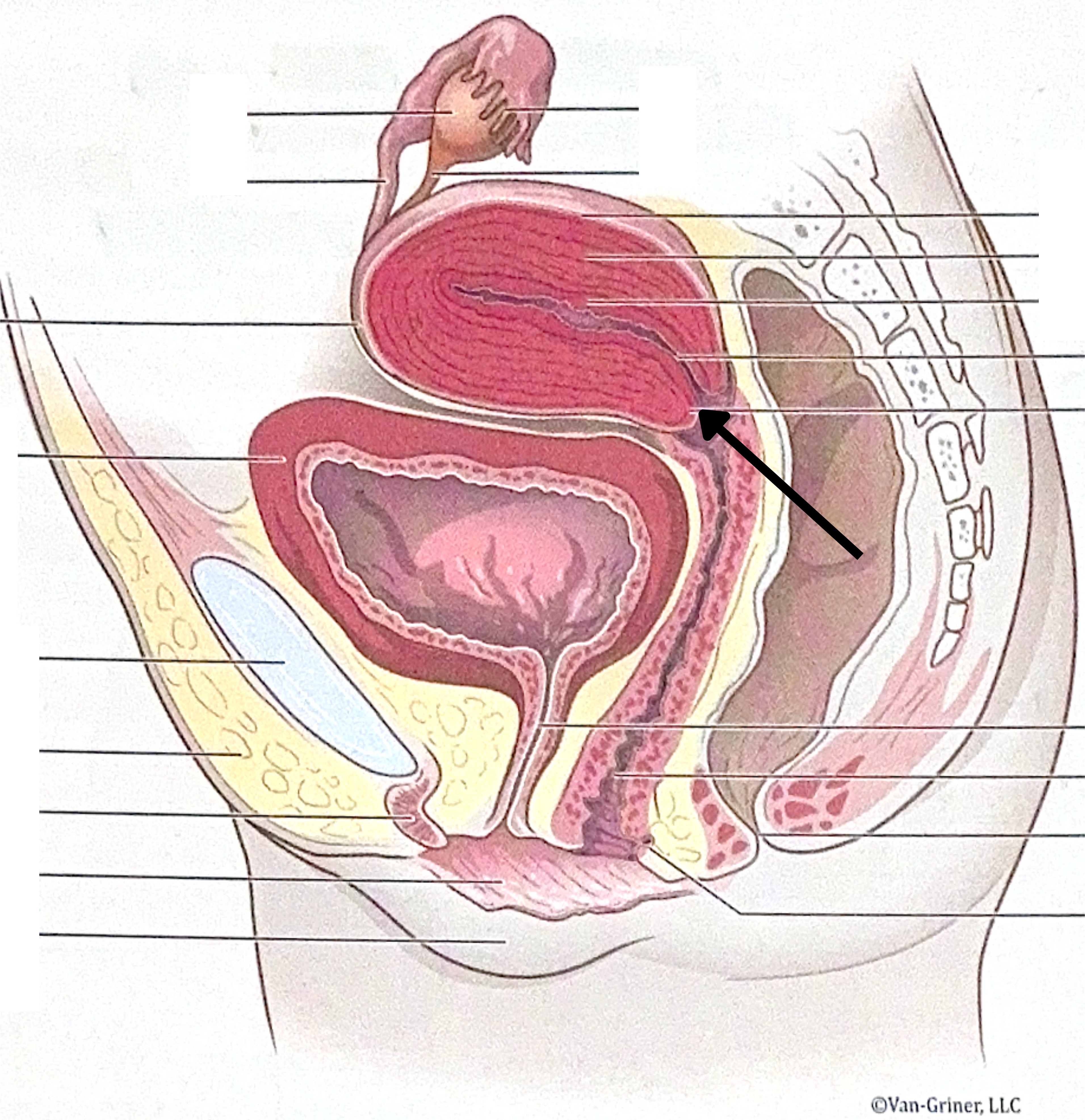 <p>What is the structure indicated in the image?</p>