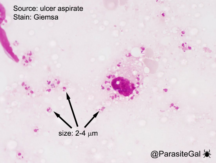 <p>Found in tissue, seen with Leishmania and <u>Trypanosoma cruzi.</u> Retracted flagellum, kinetoplast and nucleus. 2-3 um, so can only see nucleus on scope</p>