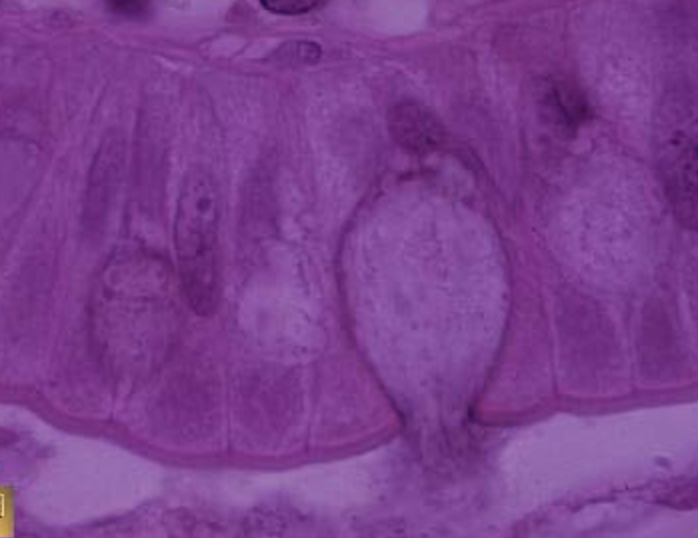 <p>tissue type </p>