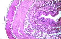 <p>classify the epithelium (histologically) of the organ shown and name the organ</p>