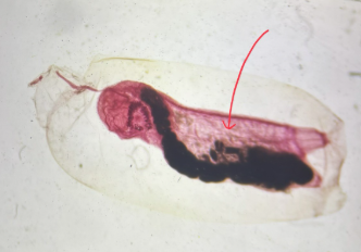 <p>Phylum<br>Subphylum</p>