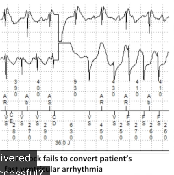<p><strong>Evaluate therapy</strong></p><p>Determine success for type of therapy delivered</p><p>Shock: conversion, energy, charge time, impedance</p><p></p>
