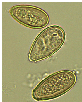 <p>describe the <strong>liver</strong> fluke egg</p><p>…, …, and a … … at … …</p>