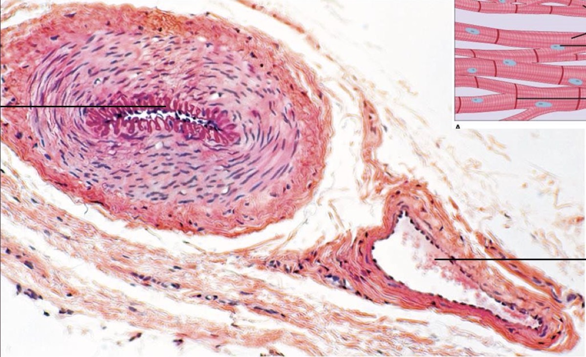 <p>Which one is the artery? </p>
